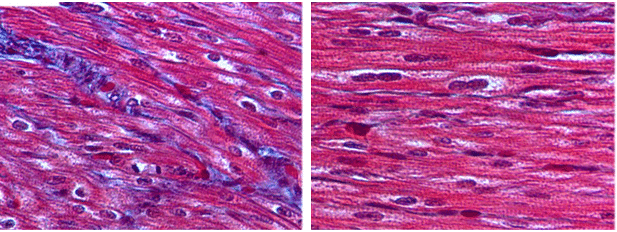 fibrosis-staining-image