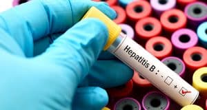 Hepatitis B Vaccine