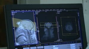 A baboon scan