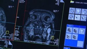 Baboon brain scans