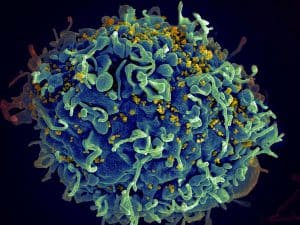 HIV Infecting a Human Cell