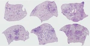 Mycobacterium tuberculosis