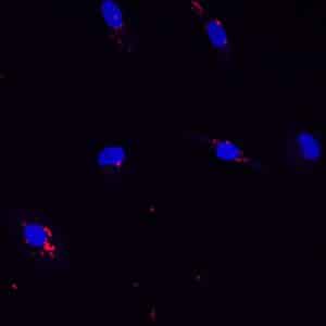 human macrophages infected with tuberculosis