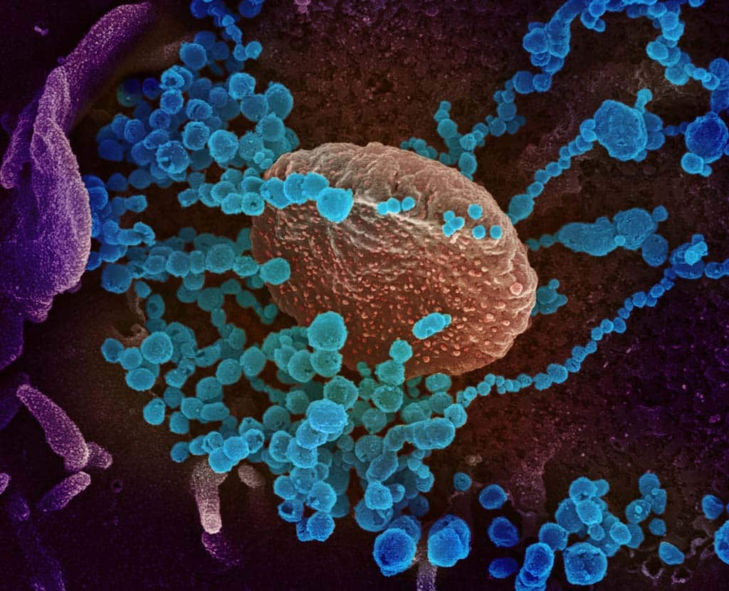 Novel Coronavirus SARS-CoV-2