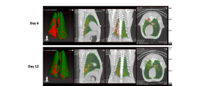 Cone beam CT Scan