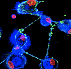 ebola-infected macrophages connected by tunneling nanotubes.