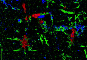 siv in microglia cells