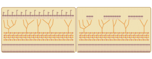 Modified bladder cancer treatment