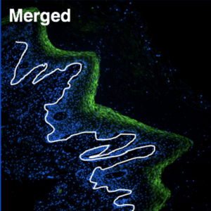 Microscopy image of vaginal tissue