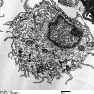 Alveolar macrophage-like cell