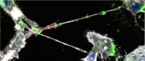 Image of an Ebola Nanotube