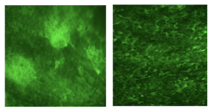 Fluorescent microscopy shows two images, one of organoids infected with H5N1 that show signs of inflammation and scar tissue, the other has been treated with a ROCK1 inhibitor and does not show scar tissue.