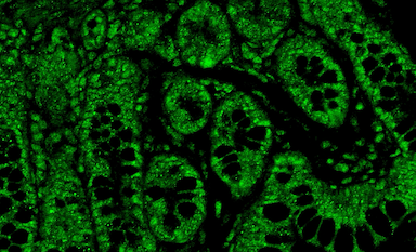 serotonin-receptors-gut-texas-biomed rectangle2
